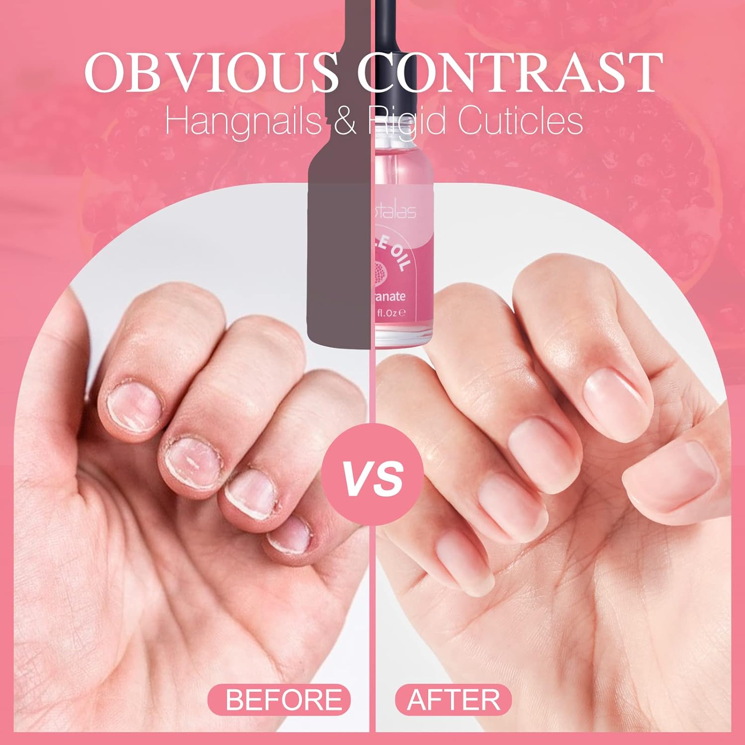 Foriotalas Cuticle Oil for Nails,Jojoba Nail Cuticle Oil for Manicure Contain Vitamin B&E,Solar Hydrating Oil Strengthens Nail Conditioner,Natural Cuticle Oil Prevents Hangnails & Chapped-Pomegranate : Everything Else