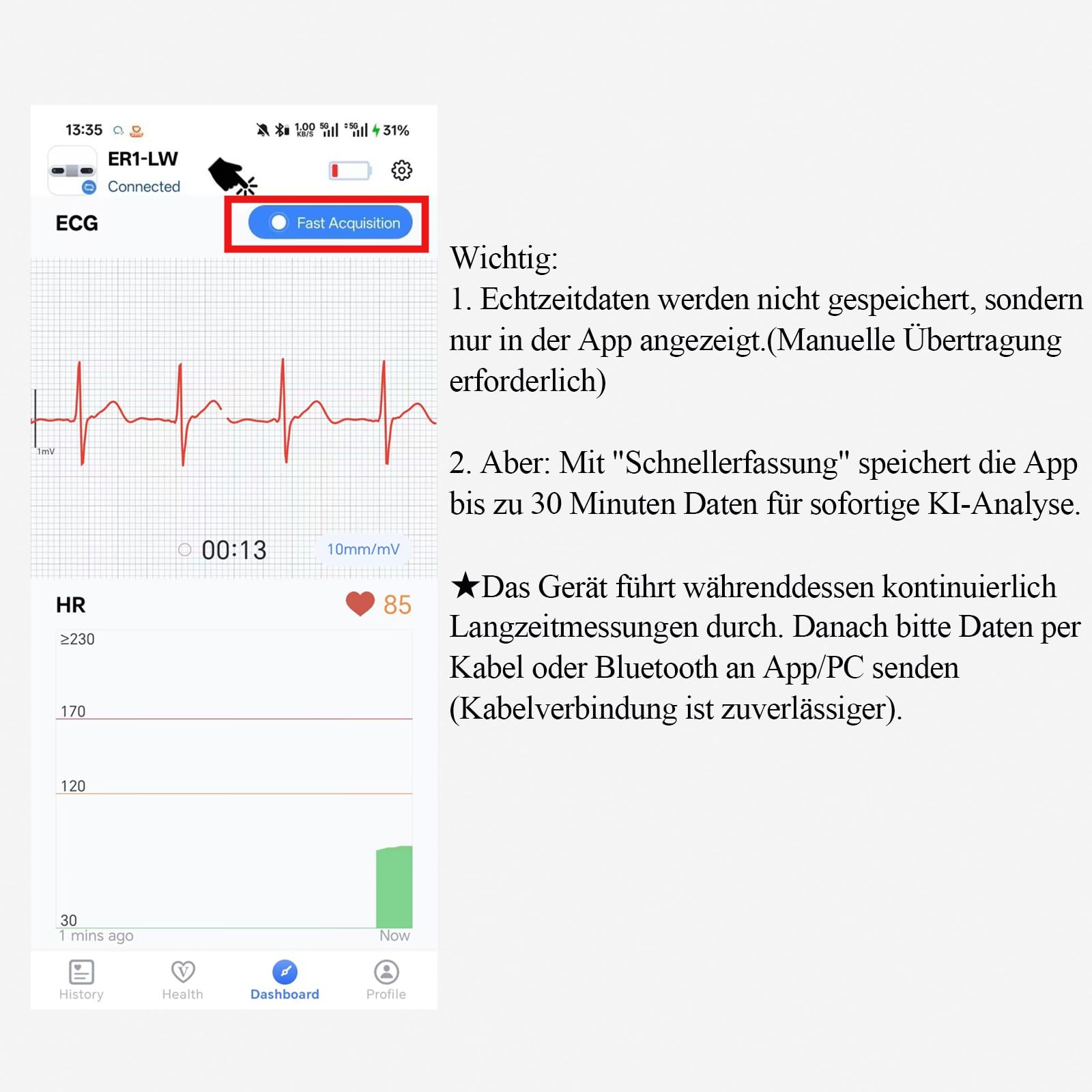 CheckMe ER1-LW 72 Stunden Langzeit-EKG Gerät mit AI-Analyse | EKG Gerät für Zuhause, EKG-Ereignismarker-Funktion, App & PC-Software, Kompatibel mit Allgemeine Elektrodenpads