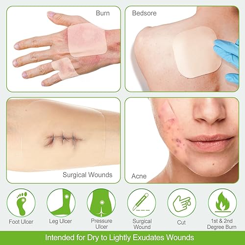 Miniatura 5 de Paquete de 20 apósitos hidrocoloides hidrocoloides extrafinos de 4 x 4 pulgadas para exudados ligeros, úlceras por presión, úlceras por presión,