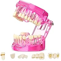 Vista 1 de Modelo de dientes con enfermedad de Outus, modelo de implante dental con dientes removibles, estándar de dientes patológicos para demostración