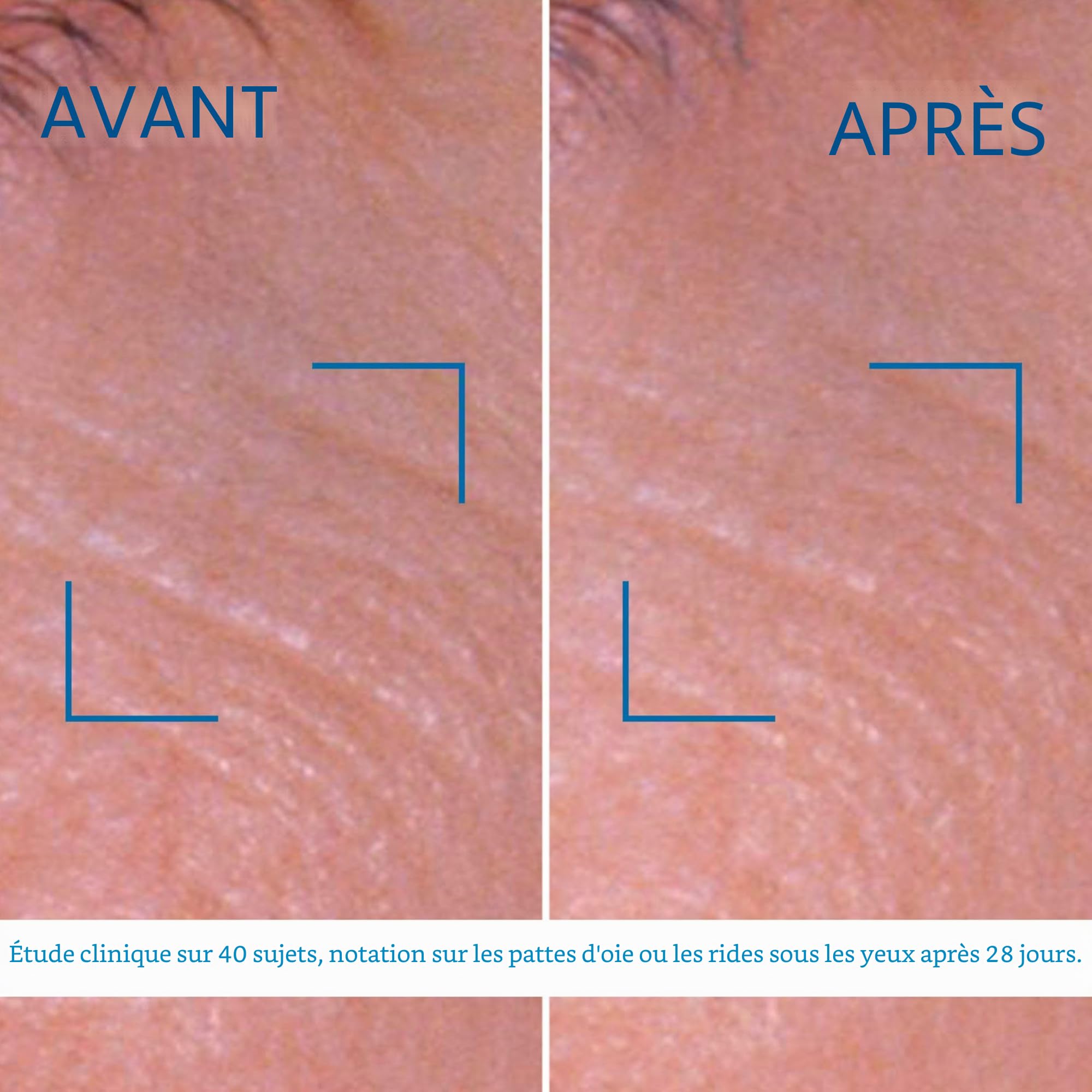 BIOTHERM Blue Pro Retinol Eye Cream Anti-Âge Contour des Yeux 15 ml