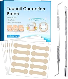 Ingrown Toenail Treatment, 60Pcs No Glue Ingrown Toenail Corrector Patch, Professional Painless Pedicure for Toenail, Ingrown Toenail Removal Kit with File and Lifter