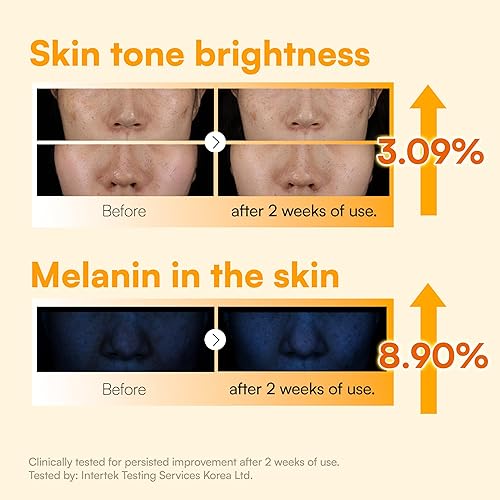 Miniatura 4 de Face Republic Vita Radiance Niacin 10 Cream 1.7 fl oz 1.69 fl oz | Revitalizante, cobertura natural | Niacinamida 10%, ácido ascórbico, pantenol,