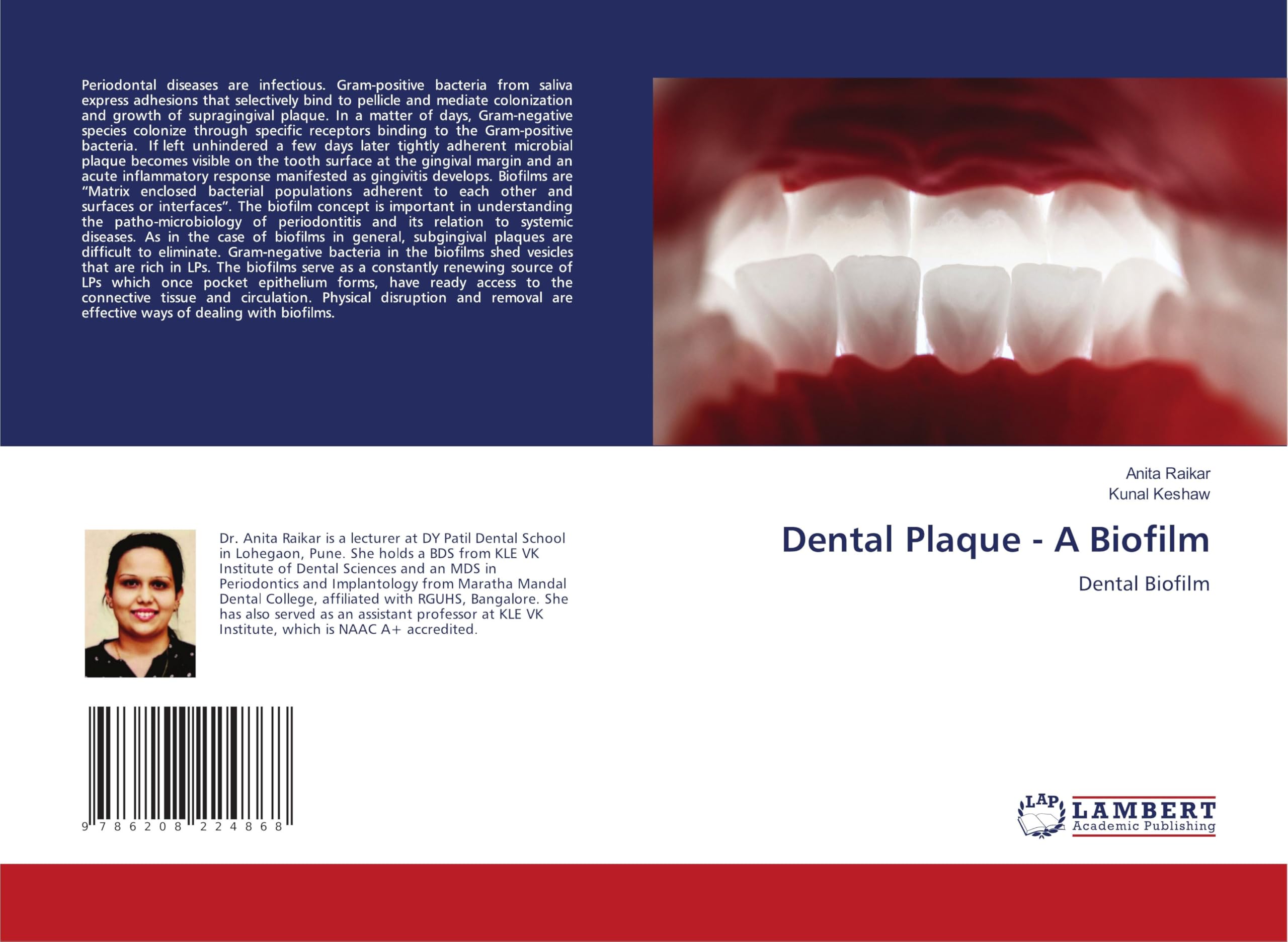 Dental Plaque - A Biofilm: Dental Biofilm