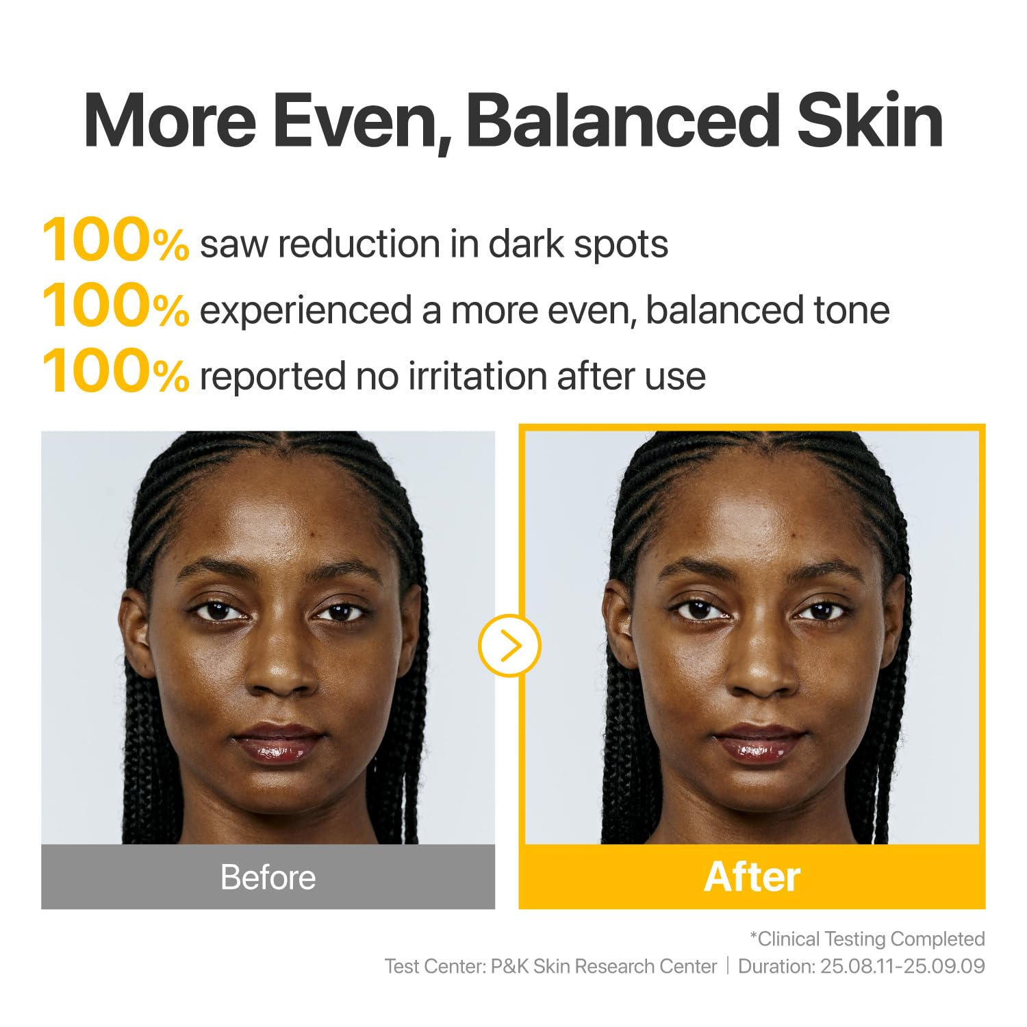 can glutathione darken skin The Side Effects of in Whitening: What You Need to Know does glutathione really lighten skin