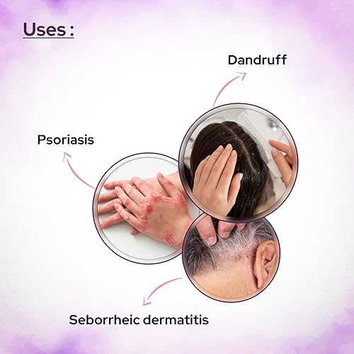 Miniatura 6 de Plaintar Loción de alquitrán de hulla sin dejar en loción  reduce las incrustaciones, sequedad y picazón, loción de alquitrán de carbón para caspa,