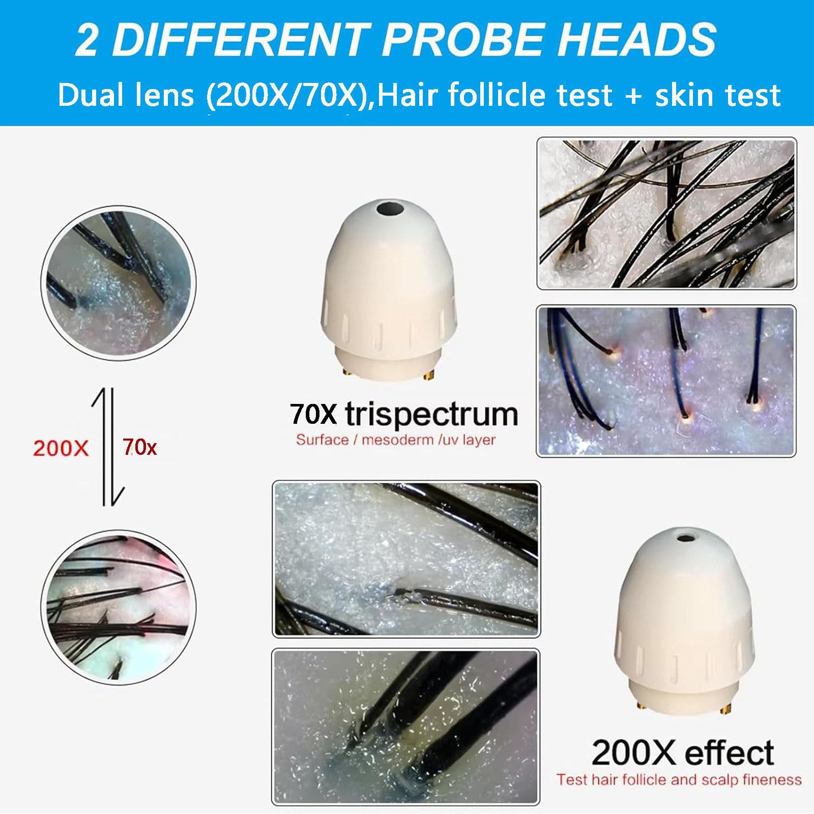 Analizzatore Pelle Capelli HD LCD 15 Pollici Ingrandimento 70x/200x Rilevatore Follicoli Macchina Analisi Pelle
