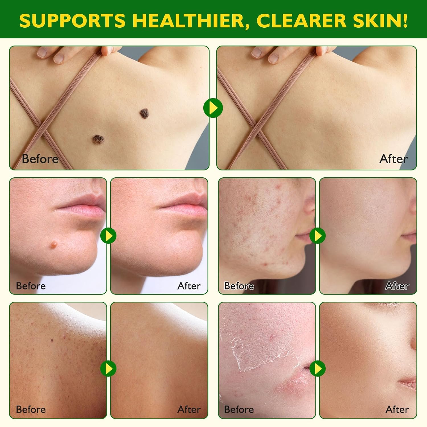 Bee Venom Comprehensive Cream 4.2 Oz, Bee Venom Skin Restoration Cream for Face & Body, Firms and Rejuvenates, Reduces Blemishes, Smoothes Wrinkles & Fine Lines, Natural Moisturizer for All Skin Types - Image 4