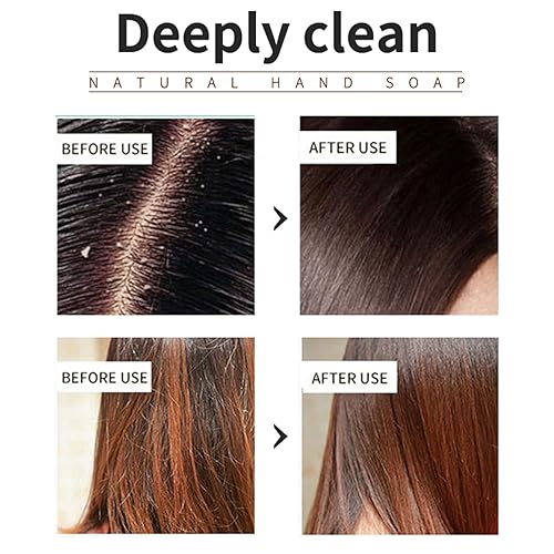 Miniatura 5 de Rosemary - Barra de champú para el cabello, limpieza profunda para cabello y cuero cabelludo, jabón de champú de romero, champú orgánico de romero,