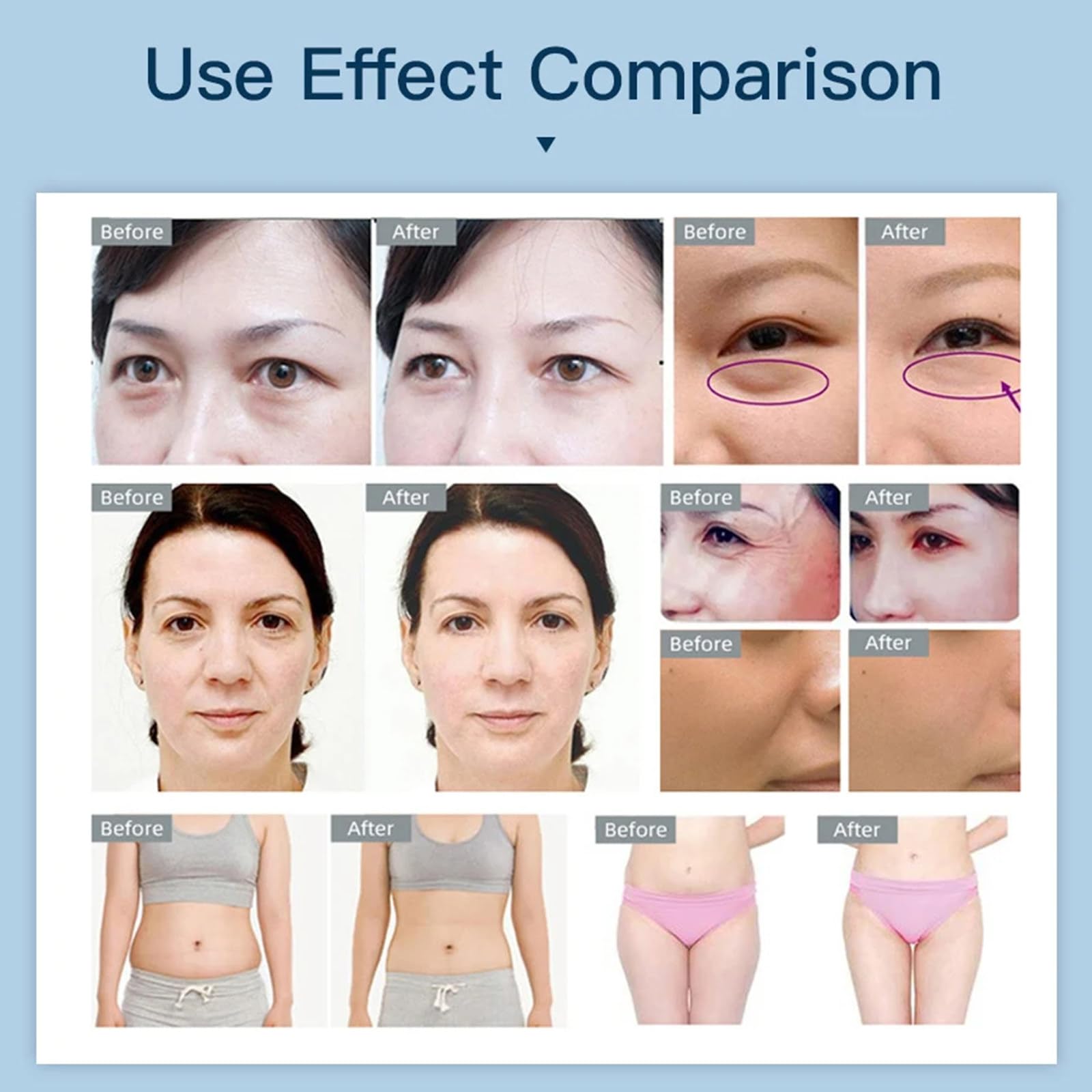MáQuina CavitacióN Al VacíO UltrasóNica, Radiofrecuencia 40K Rf - MáQuina Para Esculpir El Cuerpo 4 En 1 Apriete La Piel, MáQuina Belleza Facial Del Cuerpo, Para Cara Brazo Cintura