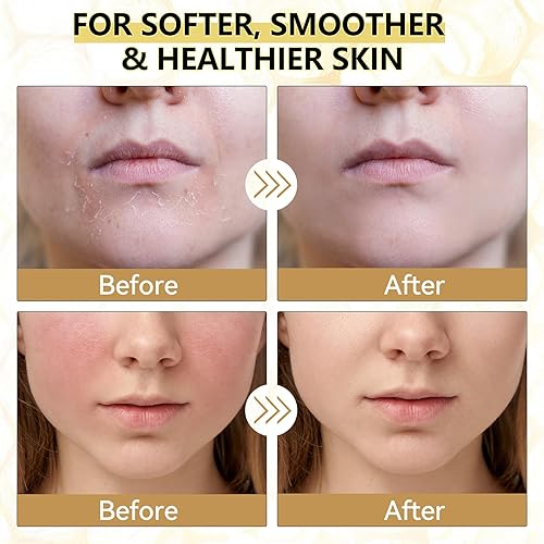 Miniatura 4 de Sarga de ternera para la piel, sargo orgánico y bálsamo de miel para la cara, hidratante facial natural, crema para el cuidado de la piel de ternera