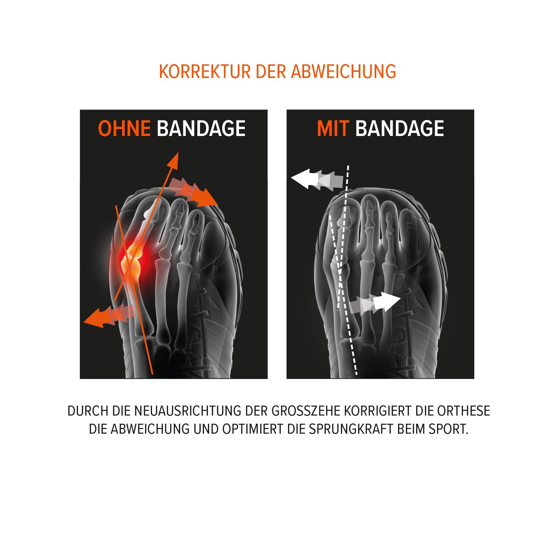 Epitact | Hallux Valgus Korrekturbandage für den Sport | Begradigt und entlastet den großen Zeh in Sportschuhen bein sport | Technische Stoffe, ultradünn und leicht | Französische Innovation (M)