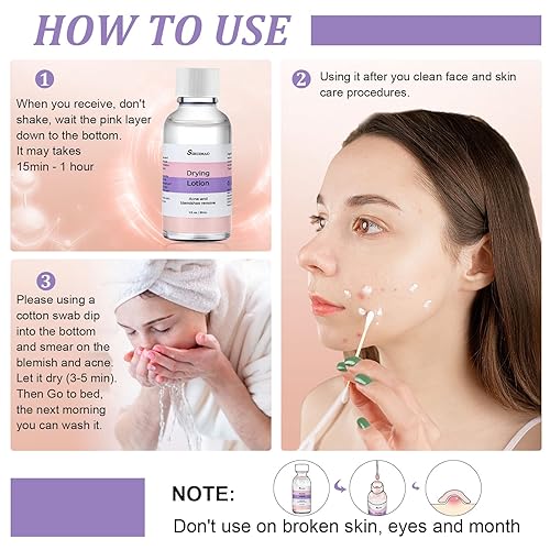 Miniatura 5 de Loción de secado para el acné persistente (1 onza), tratamiento de manchas de acné y acné durante la noche para cara y cuerpo, loción de espinillas,