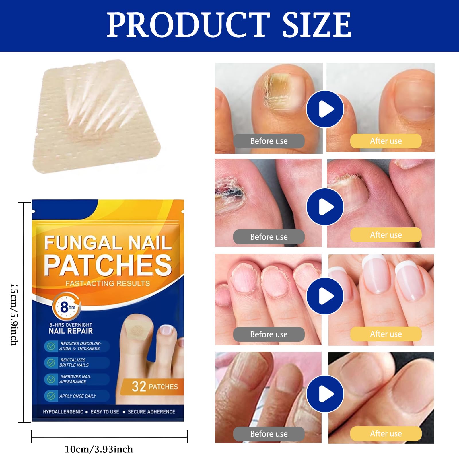 Fungal Nail Patches, Cuscinetti Multiuso per la Riparazione delle Unghie dei Piedi – Trattamento per Micosi delle Unghie dei Piedi Extra Forte, per Riparare Unghie Danneggiate (A)