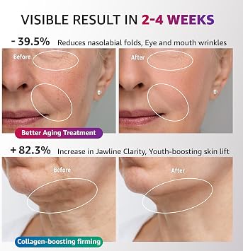 Red Light Therapy for Face and Neck 4 in 1 Facial Massager Tool