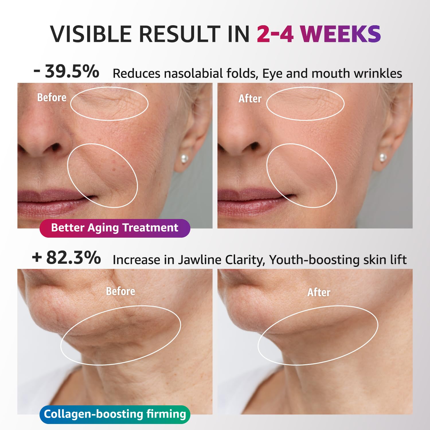 Red Light Therapy for Face and Neck, Renewal Face Lift Device with Vibration Tech, 3 in 1 Face Massager Tool with Thermals, True Beauty Glow Facial Sculptor for Wrinkles, Double Chin-White - Image 2