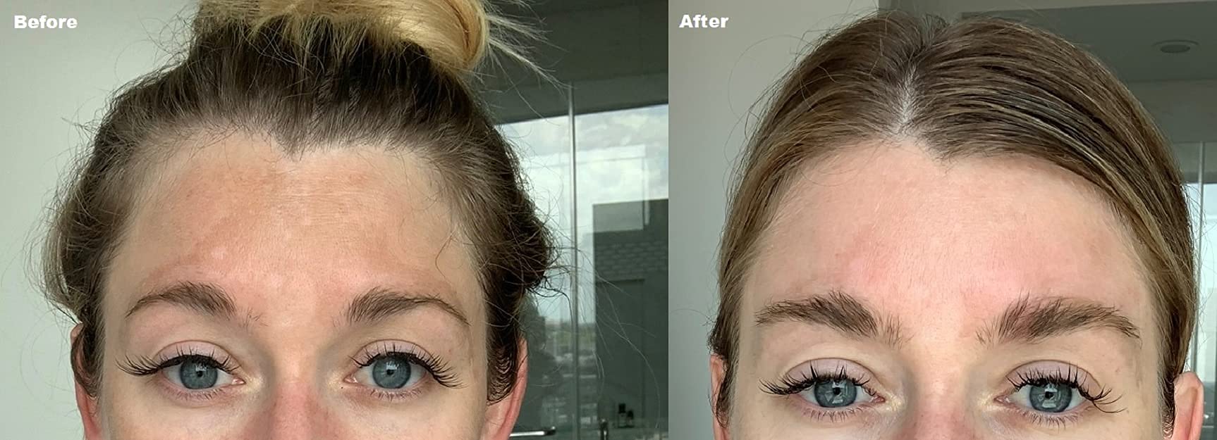 Buy 2 Hydroquinone Helps Fade Dark Spots & Melasma This Will Provide