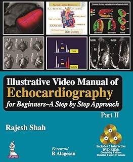 Illustrative Video Manual of Echocardiography for Beginners: A Step by Step Approach (Part II)