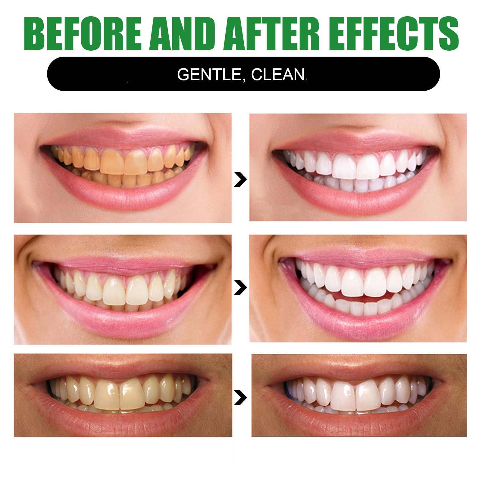 Dentifricio Sbiancante Al Carbone Di Bambù Kicklo, Dentifricio Al Carbone Di Bambù Per La Pulizia Profonda, Schiuma Dentale, Sbiancamento Dei Denti E Rinfresco Alito (7pcs)