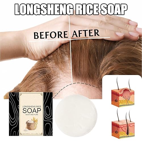 Miniatura 2 de Barra de champú, jabón de champú hecho a mano con agua de arroz, extracto de aloe vera e ingredientes naturales, tratamiento de pérdida de cabello,