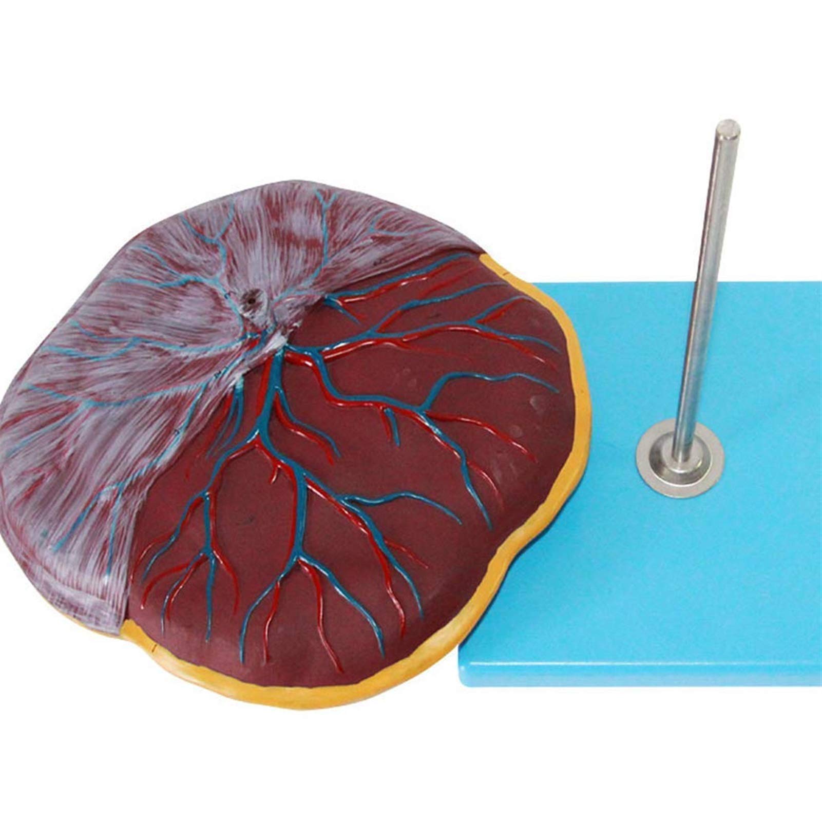 Scientific Human Anatomy - Modelo de placenta y cordón umbilical, equipo médico, modelo de anatomía humana, ayuda de formación educativa médica