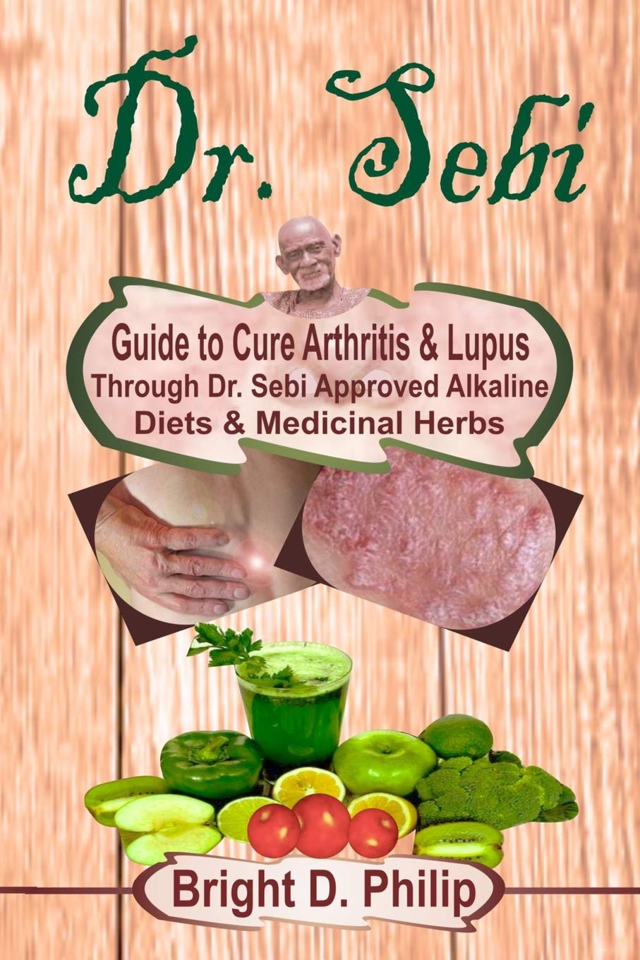 Dr. Sebi: Guide to Cure Arthritis & Lupus Through Dr. Sebi Approved Alkaline Diets & Medicinal Herbs