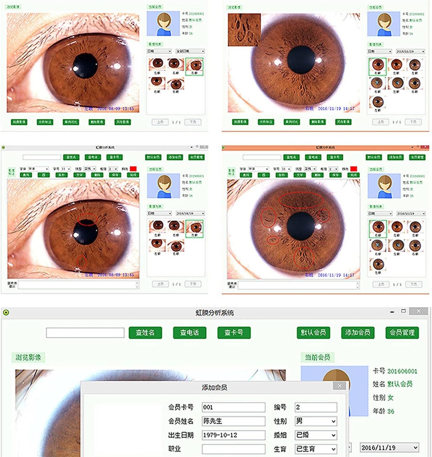 Nueva cámara de iridología con analizador de iris USB de 5.0 MP con software pro Iris en inglés, lente de iris de 30X, enfoque ajustable, alta resolución 2560 * 1920 Iriscopio