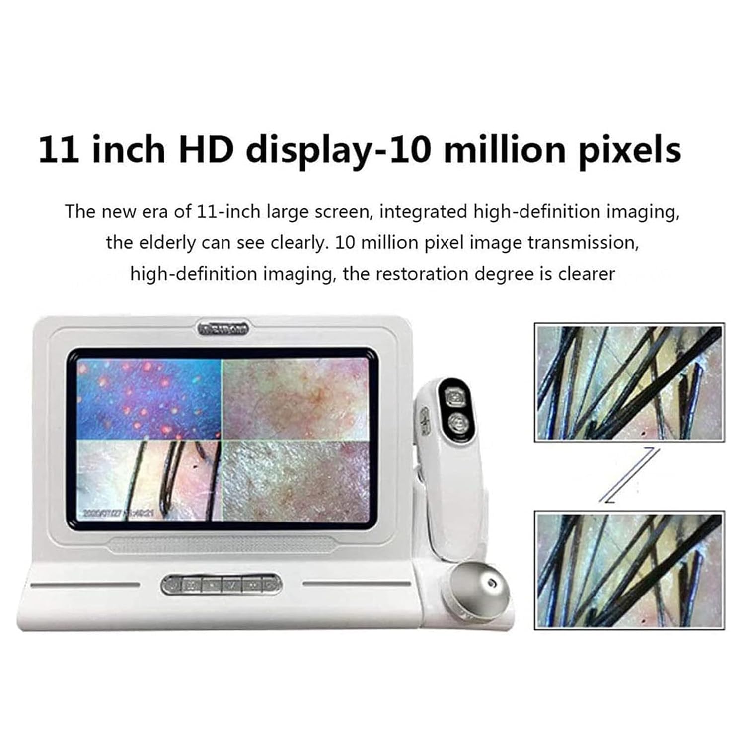 Haut Haar Analysegerät, Kopfhautanalysegerät, mit 11 Zoll HD LCD Bildschirm für Haut- und Haaranalyse, Analysegerät Multifunktionaler Digitaler Hautpflege-Analysegerät