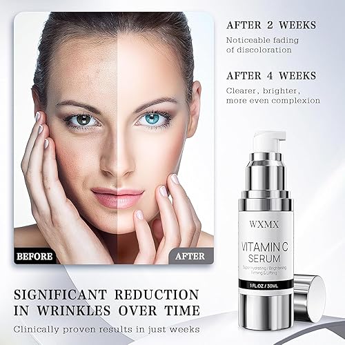 Miniatura 3 de Suero facial súper vitamina C para piel madura: fórmula hidratante antienvejecimiento todo en uno de vitamina C, ácido hialurónico, reafirmante