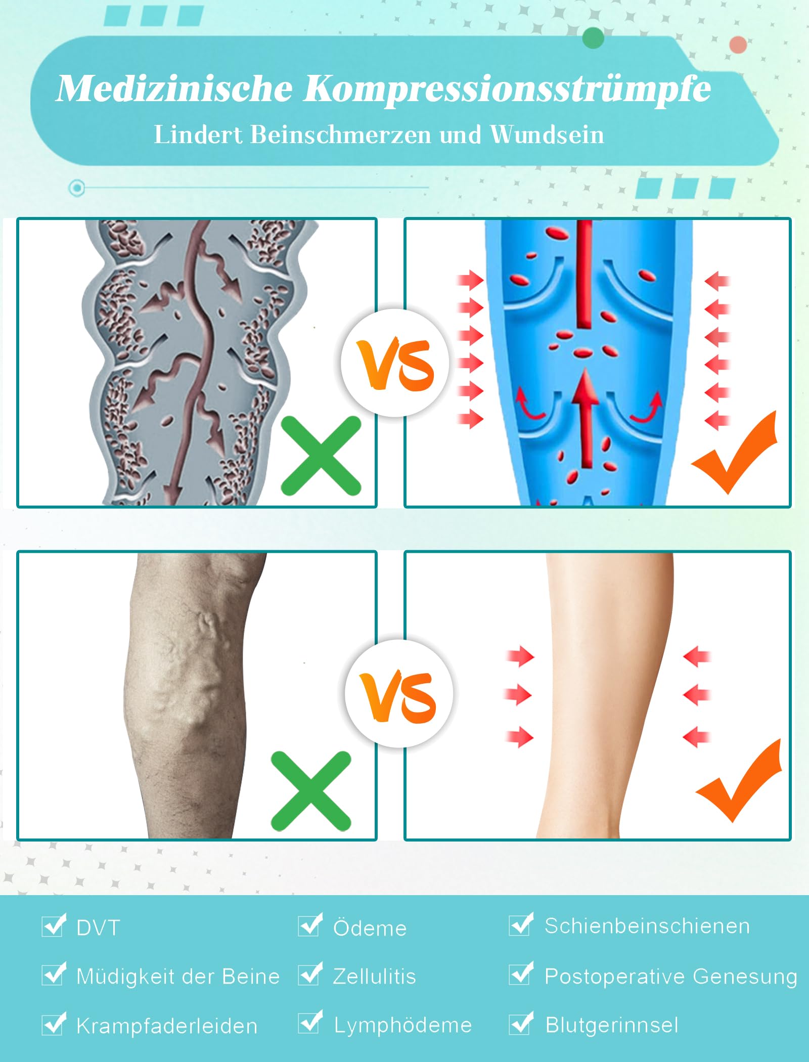 20-30 mmHg Bas de compression médicale pour homme et femme Classe 2 Bas de contention longs à la cuisse Bout fermé Chaussettes de compression avec bande en silicone pour varices, œdèmes, vol