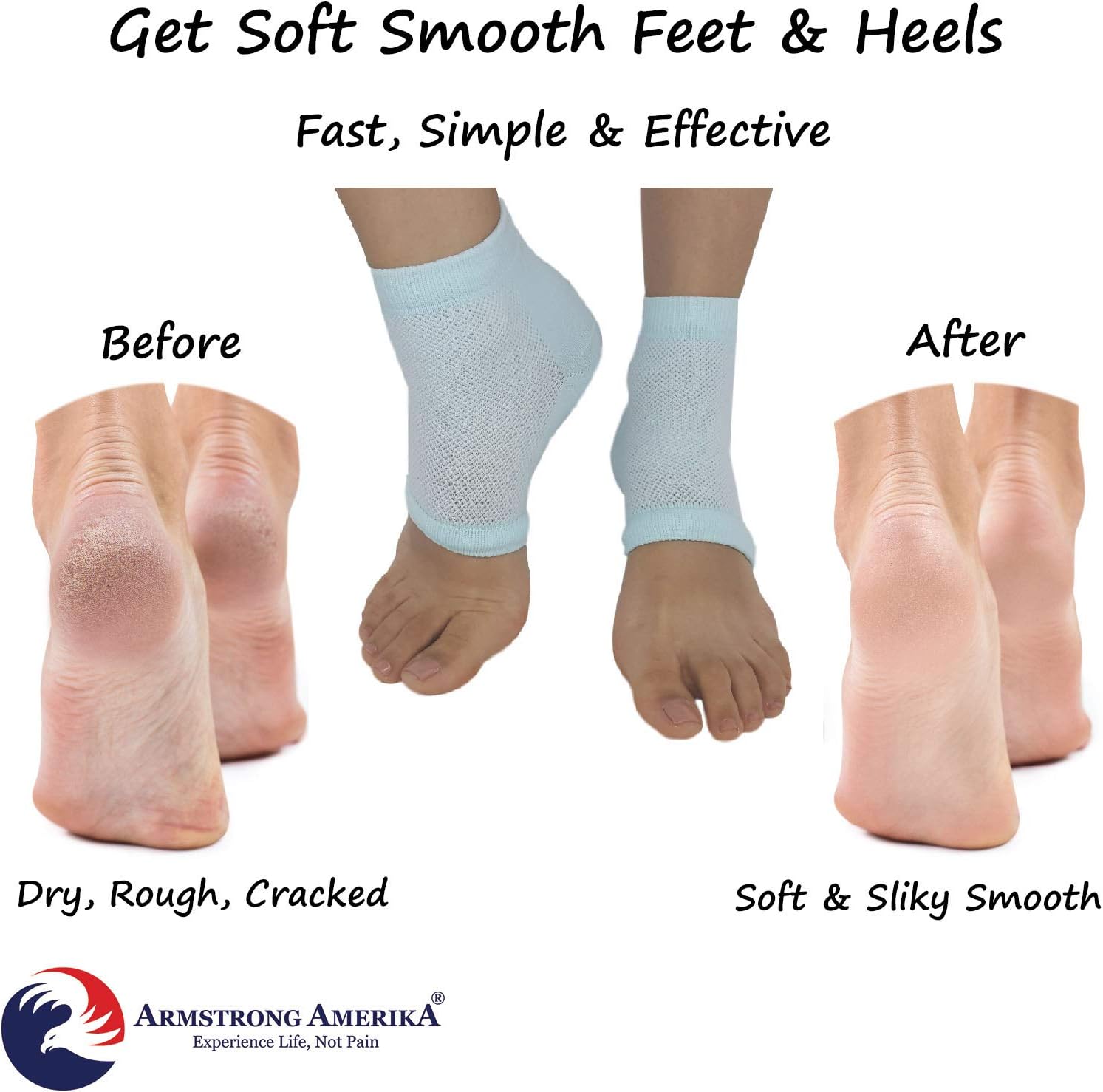Moisturizing Socks for Cracked Heel Repair - Dry Heels Treatment for Rough Feet, Toeless Aloe Lotion Moisturizer Silicone Gel Lined Moisture Spa Heel Socks Pedicure Foot Care for Women Men Fits Most : Beauty & Personal Care