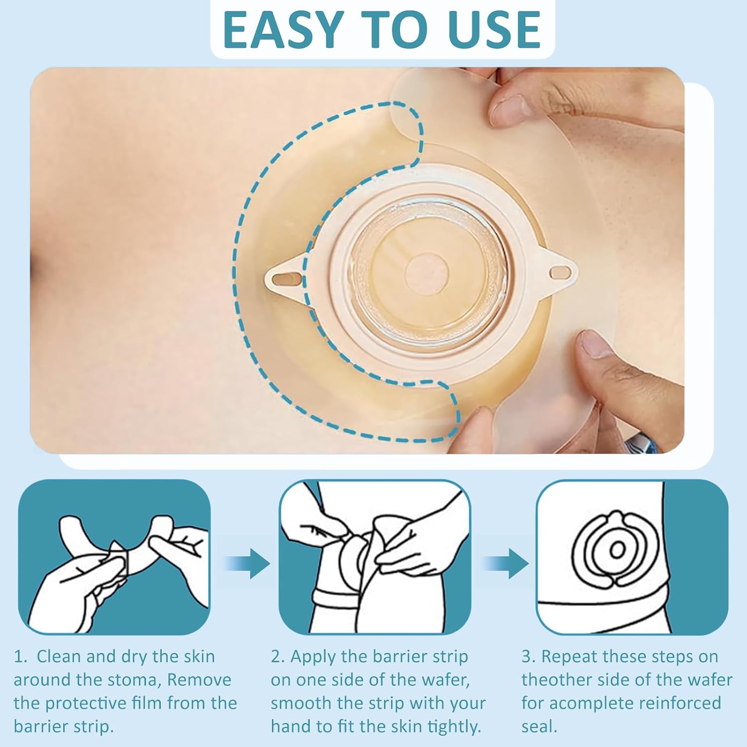 Ostomy Barrier Strips, Elastic Barrier Strips Skin-Friendly Hydrocolloid Sealing Strips to Reinforce Ostomy Barriers,Protect Peristomal Skin & Extend Wear Time, Essential Ostomy Supplies (12)