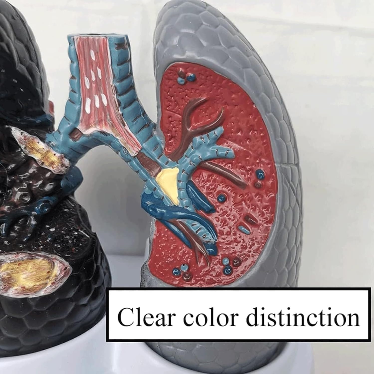 人体肺解剖モデル 喫煙肺と健康な肺モデル 人体呼吸器系臓器モデル 正常および病的な肺解剖モデル 医療教育用