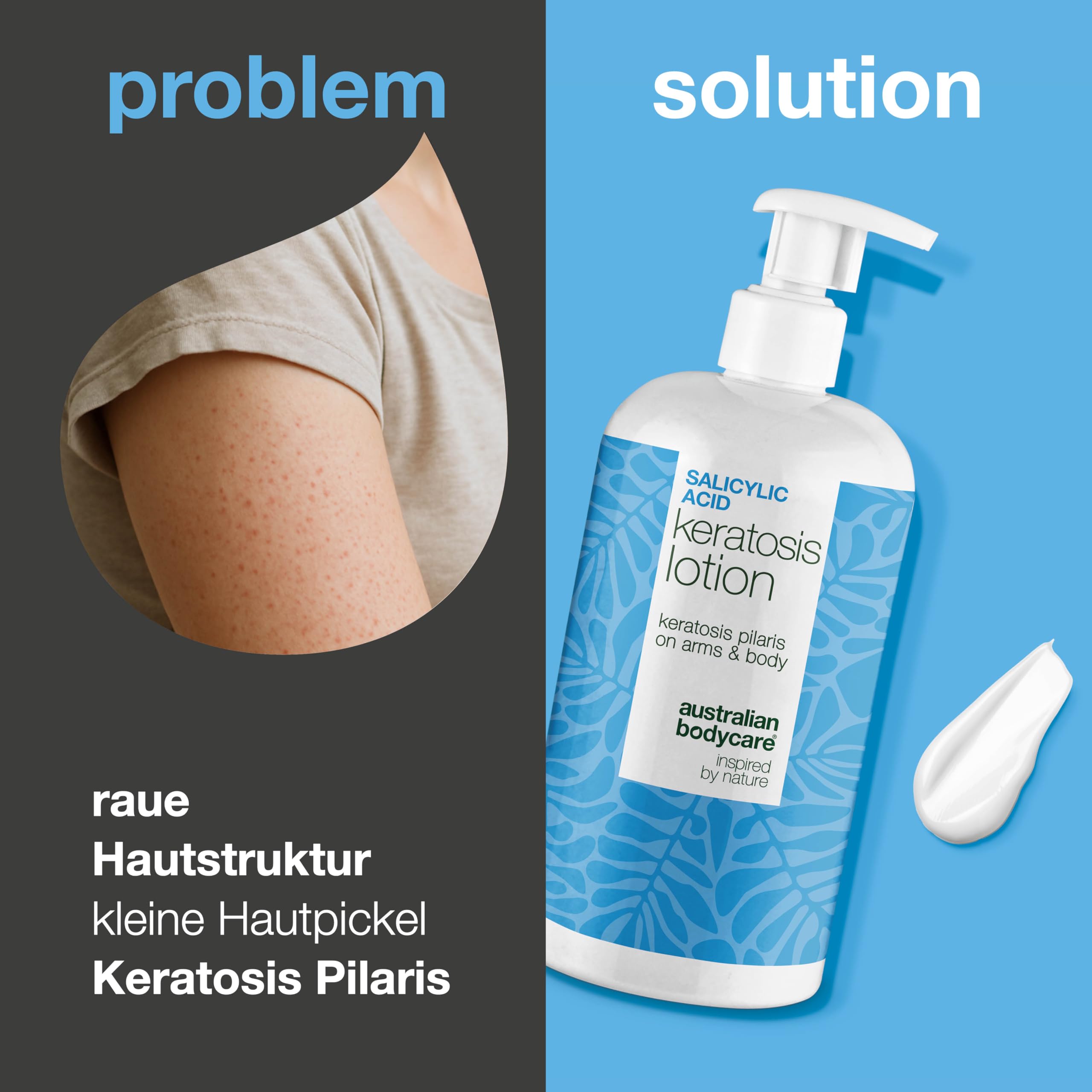 Bodylotion gegen Reibeisenhaut – Glättet Keratosis Pilaris & Erdbeerhaut – mit Salicylsäure, Niacinamide und Zink PCA – Spendet Feuchtigkeit und Beruhigt Empfindliche Haut