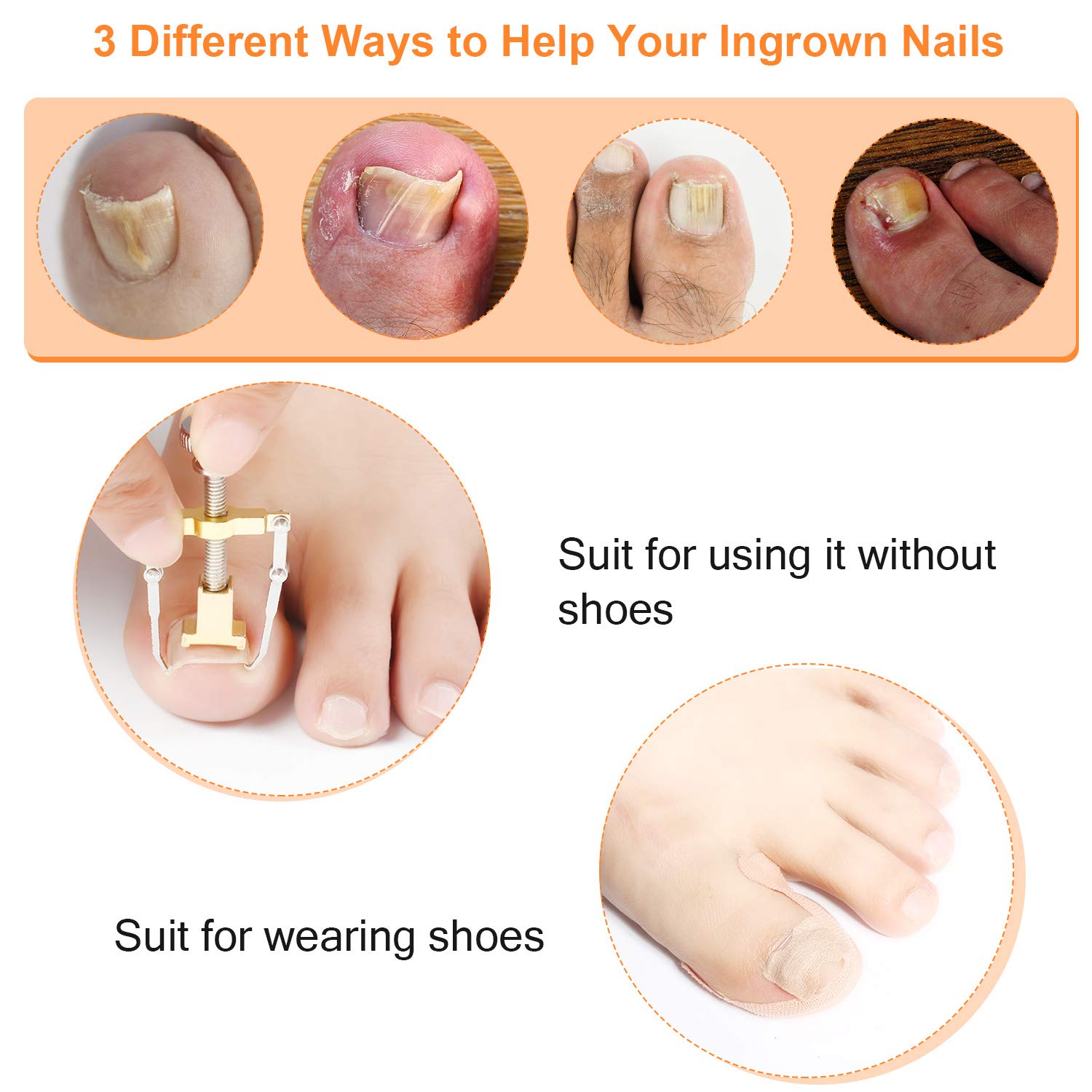 13 Pieces Ingrown Toenail Tools Kit, Includes Ingrown Toenail Lifter