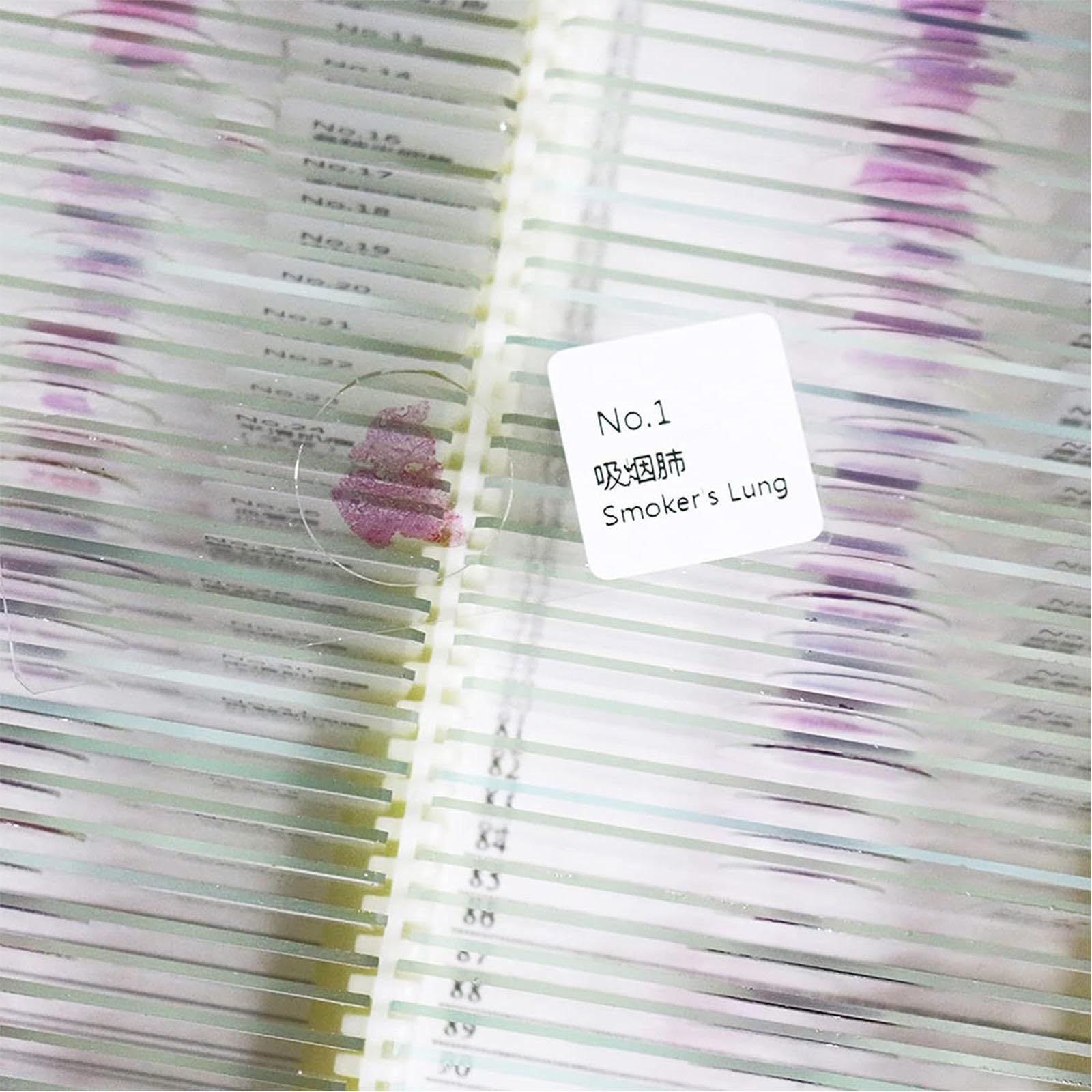 100 Piezas de Muestra de Sección Patológica Humana, Portaobjetos de Observación de Microscopio, Rebanadas Claramente Estructuradas, Material de Vidrio para Enseñanza de Educación de Estudios