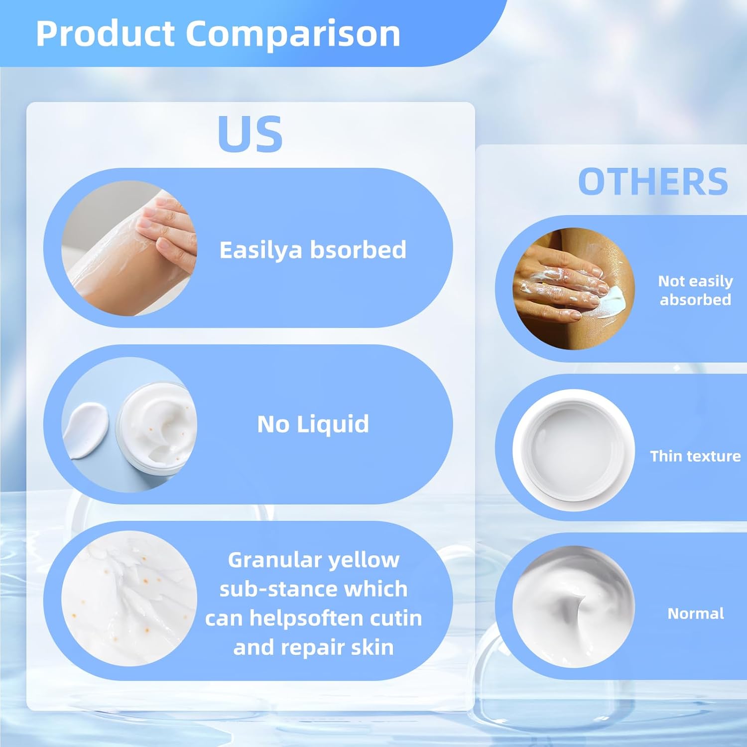 Urea Cream for Dry, Rough Skin – Moisturizing Foot and Hand Cream with Shea Butter, Glycerin & Vitamin E – Smooths Rough Heels & Thick Skin – Non-Greasy Formula, 170g - Image 4