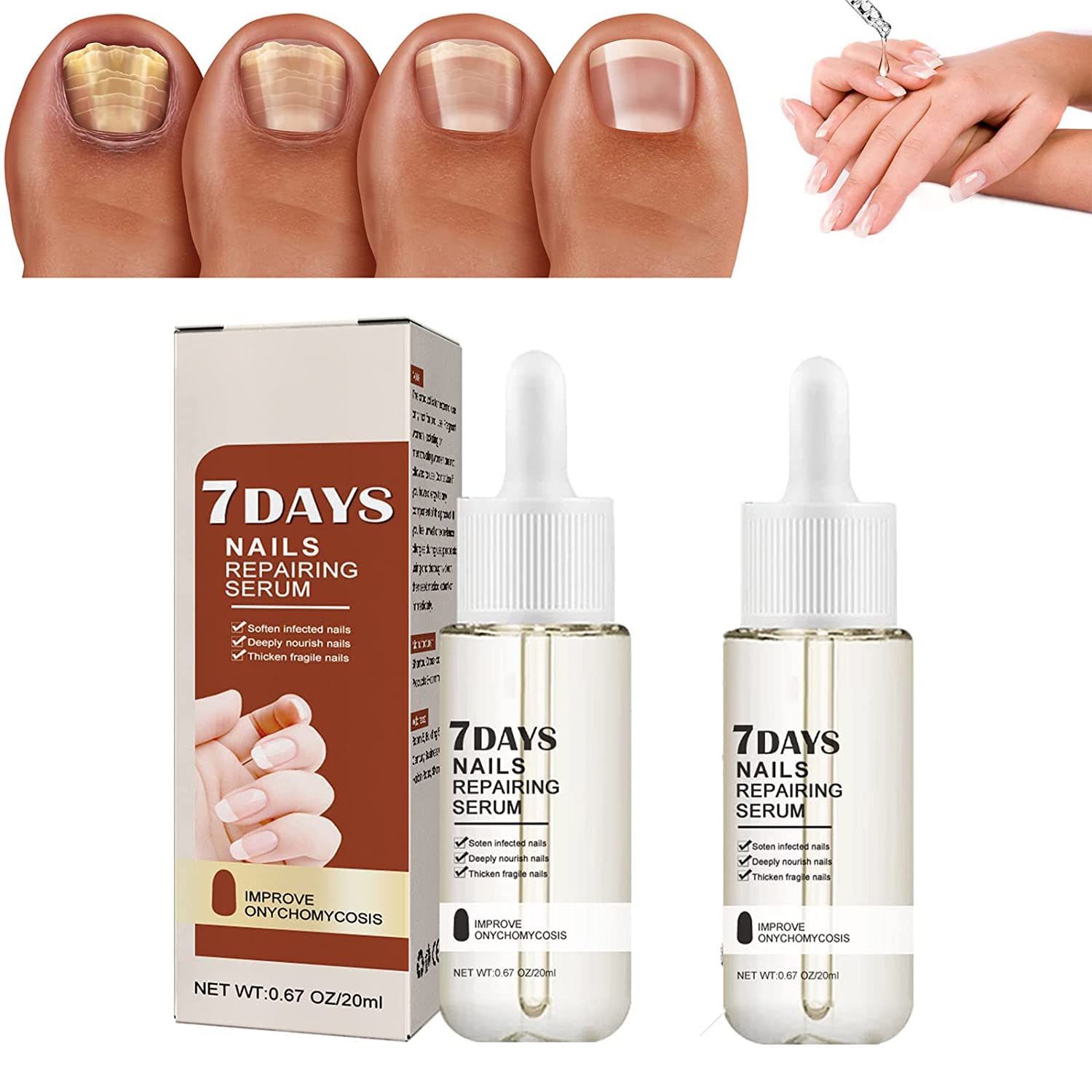 Dubush 2Pcs Gfouk 7 Days Nail Growth Power Serum Nail Cuticle Oil Strengthener 1 Week Nail Strengthening Treatment Make Nails Grow Stronger And Healthier