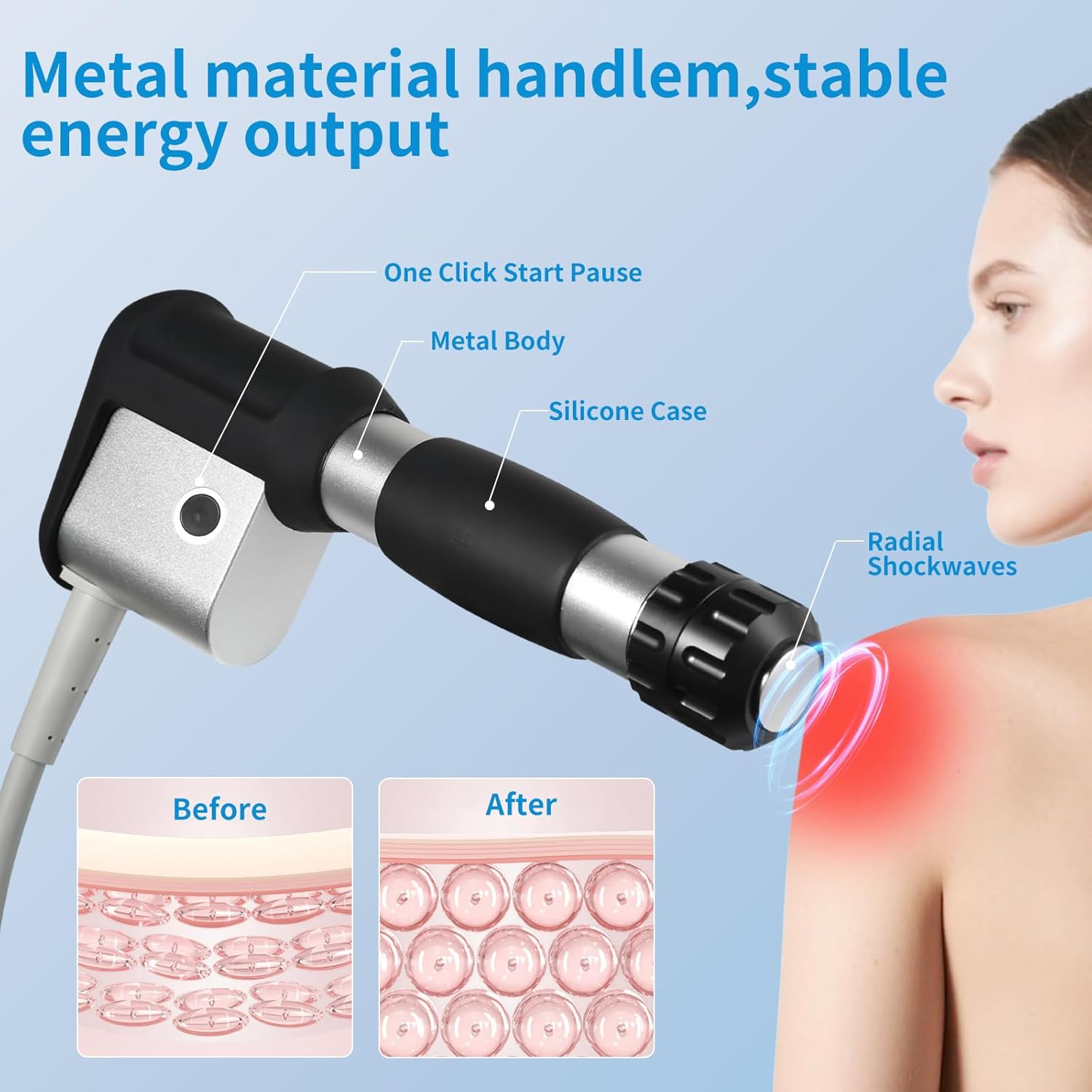 2026 Fumooean New Upgraded Shockwave Therapy Machine，Extracorporeal ESWT Shock Wave Therapy Machine for Joint Muscle Pain Relief