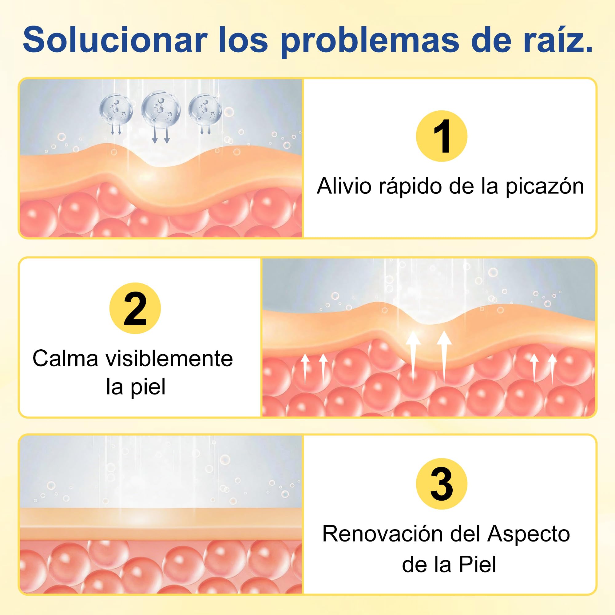 Crema para la Psoriasis,Crema Antipruriginosa 20g,Alivio del Picor y la Descamación,Cuidado Corporal para Pieles Muy Secas y Sensibles - 4