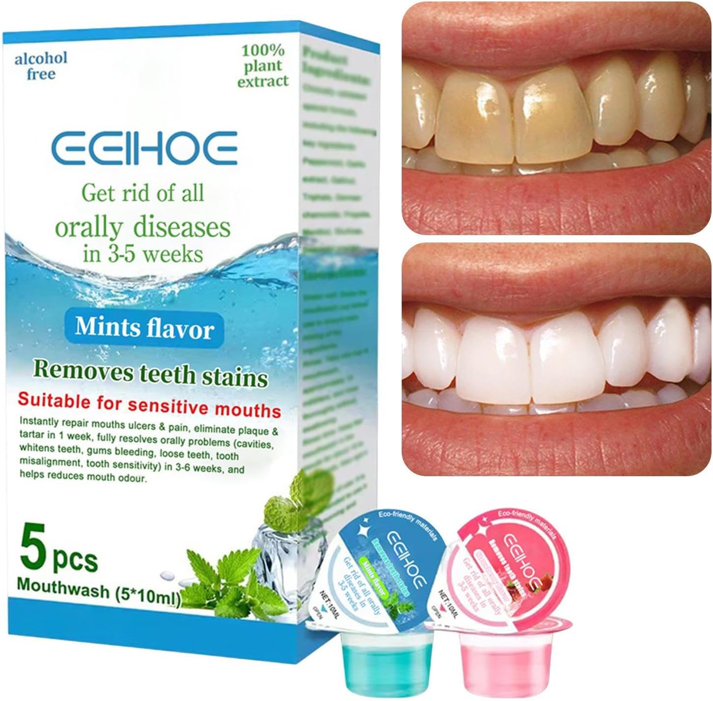 Amazon.co.jp Mouthwash Mint Flavor Jelly Cup Mouthwashes 5 Pieces