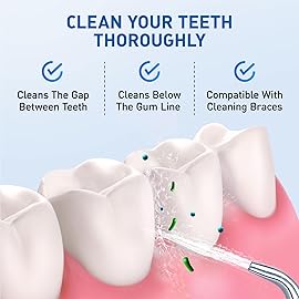 Water Flosser Replacement Tips for Waterpik, Replacement Heads for Waterpik (6 Classic Jet Tips)