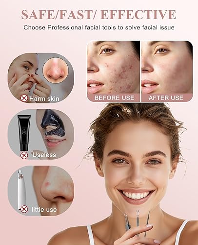 Miniatura 6 de Herramienta profesional de tratamiento de acné, herramienta profesional de eliminación de espinillas de acero inoxidable, herramienta de extracción