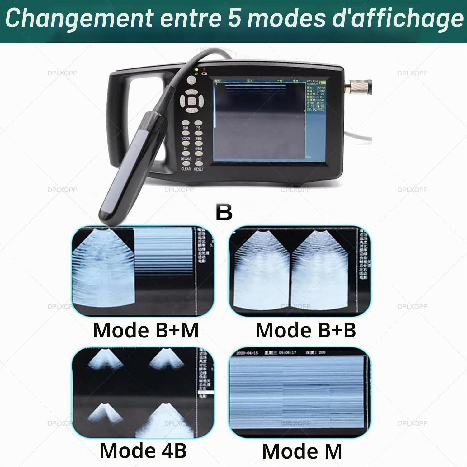 échographe Vétérinaire Portable,Appareil échographie avec Sondes (M1, M2, M3) pour Diagnostic De Gestation des Porcs,Bovins,Ovins,Chevaux,Chiens & Chats,écran LED 5.6" M3