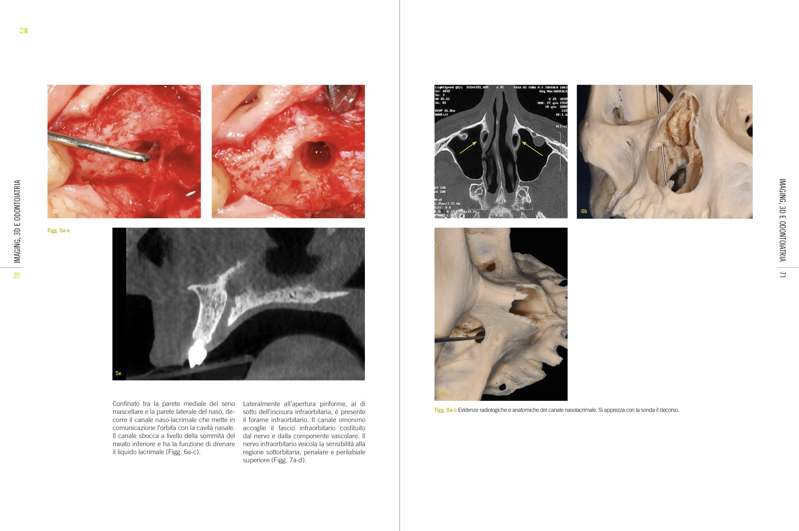 Imaging, 3D e odontoiatria. Dalla cefalometria multiplanare alla navigazione guidata in implantologia