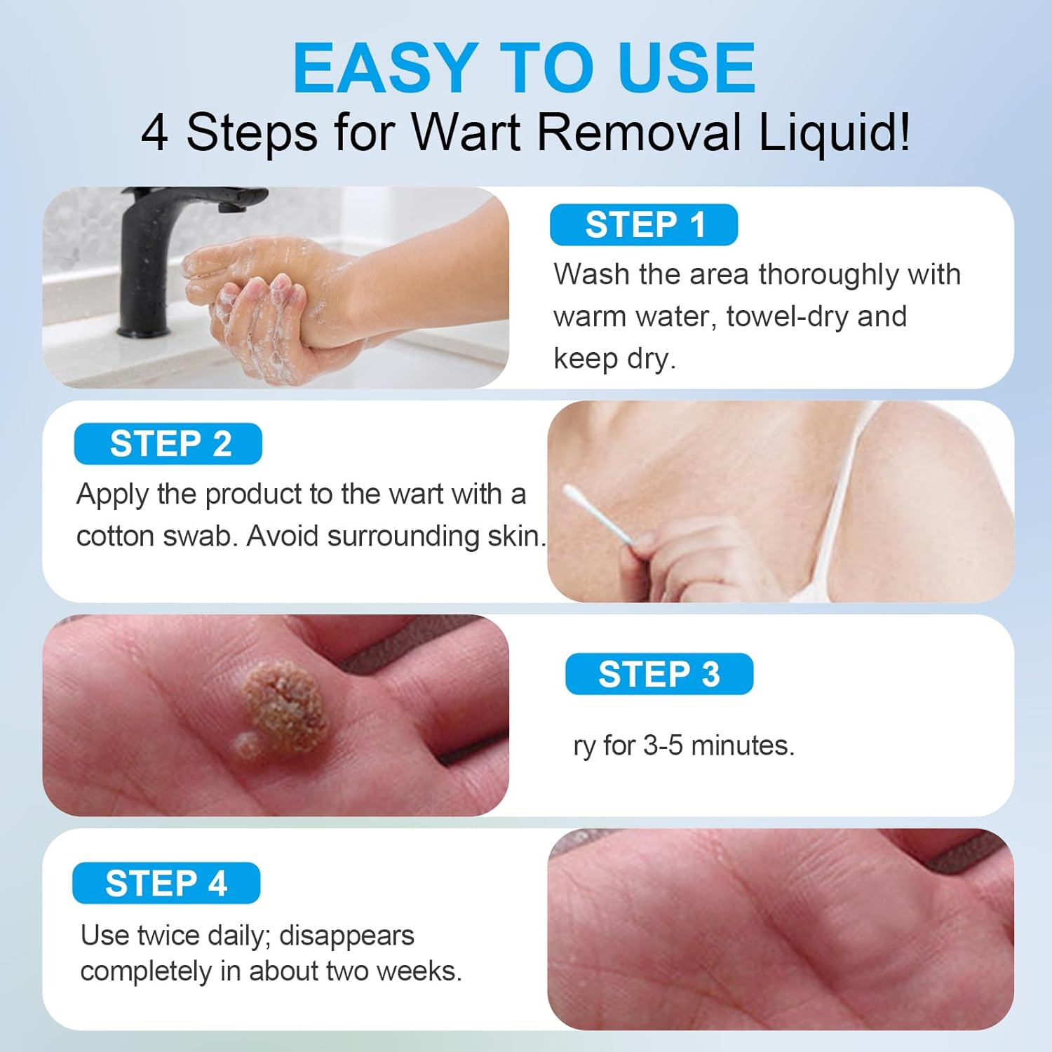 2 Packs Fast-Acting Salicylic Acid Remover: Strongest Wart Corn Removers for Feet, Body and Neck.Exclusive Formula 17% Salicylic for Plantar、Flat、Common Wart, Corn. For Men and Women - 2*30ML - Image 5