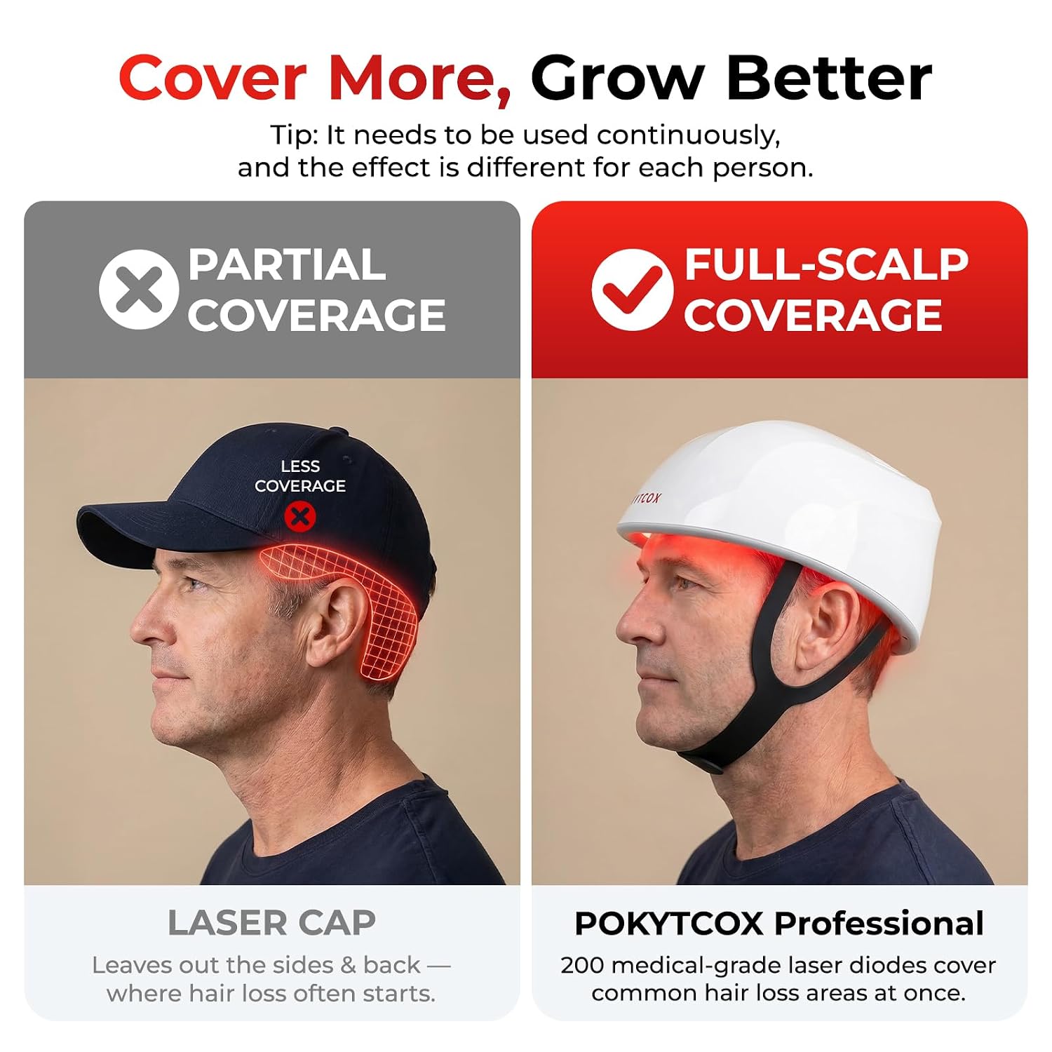 Red Light Therapy for Hair Growth Laser Cap – FDA Cleared Hair Growth Device for Men & Women, Low Level Light Therapy Cap Promotes Hair Regrowth for Thinning Hair & Alopecia, 660nm(KCA451-200S)