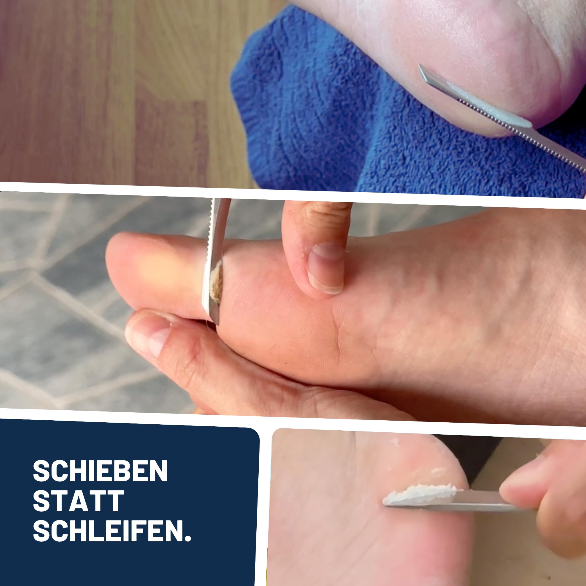 Mr. Fuss® No. 4 - Plus Pack Steel - Groß, Nagelhaut- Hornhautentferner Sparpaket 3 tlg. Aktiv-Lösung Schnell erweichend - 500 ml, Watte, Edelstahl-Schaber