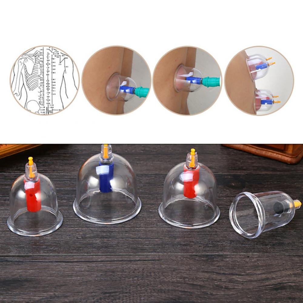 FOOJo 24-Cup-Vakuum-Schröpfset, professionelle chinesische Schröpftherapie, traditionelles chinesisches Schröpf-Massage-Set