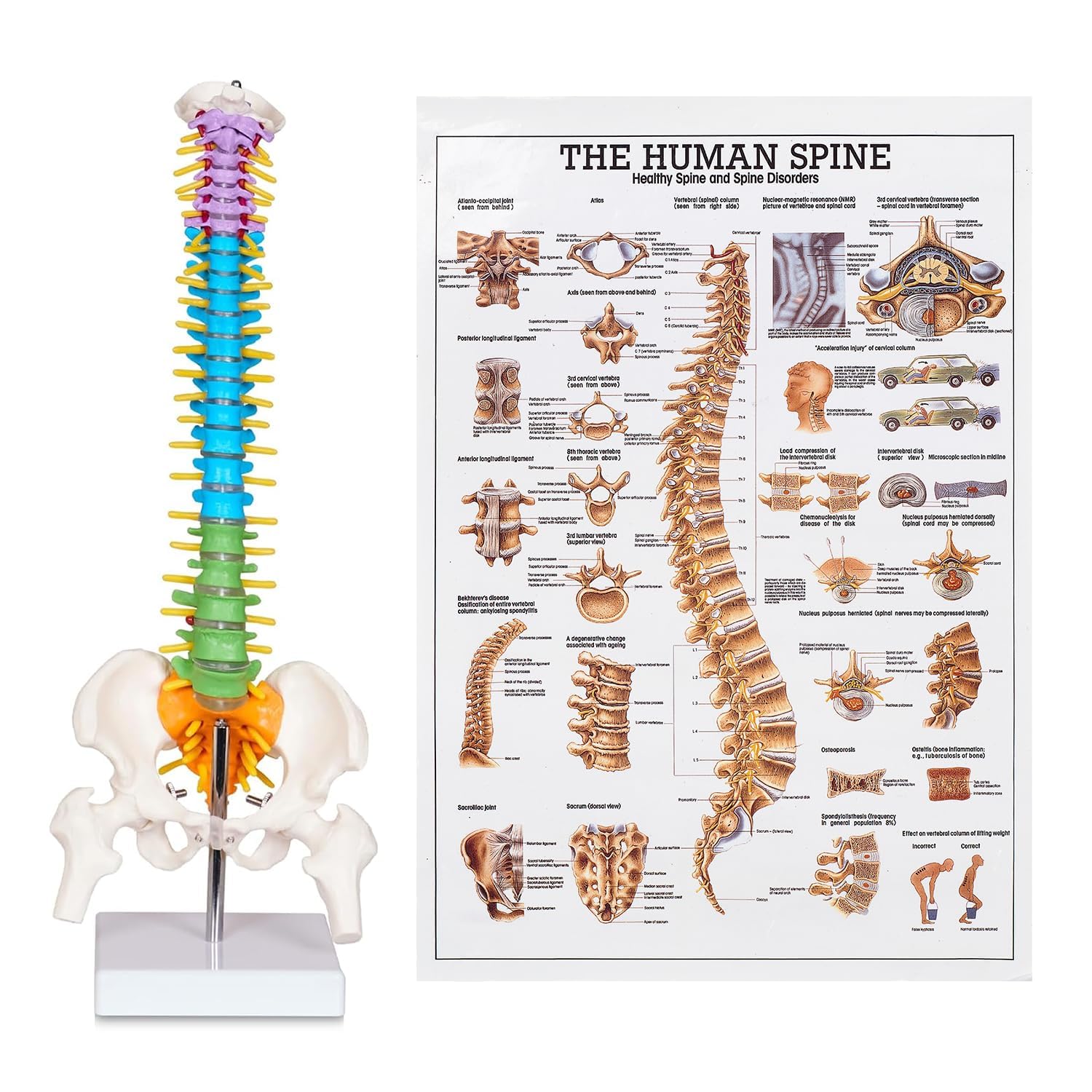 breesky Scientific Mini Spine Model, 15.5’’ Anatomical Spine Model with All Nerves, Human Anatomy Model with Stand for Instruction, Study and Display